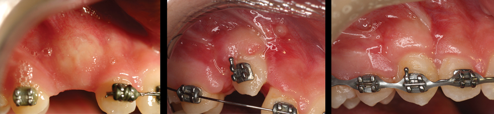 Images of before, during and after canine exposure.